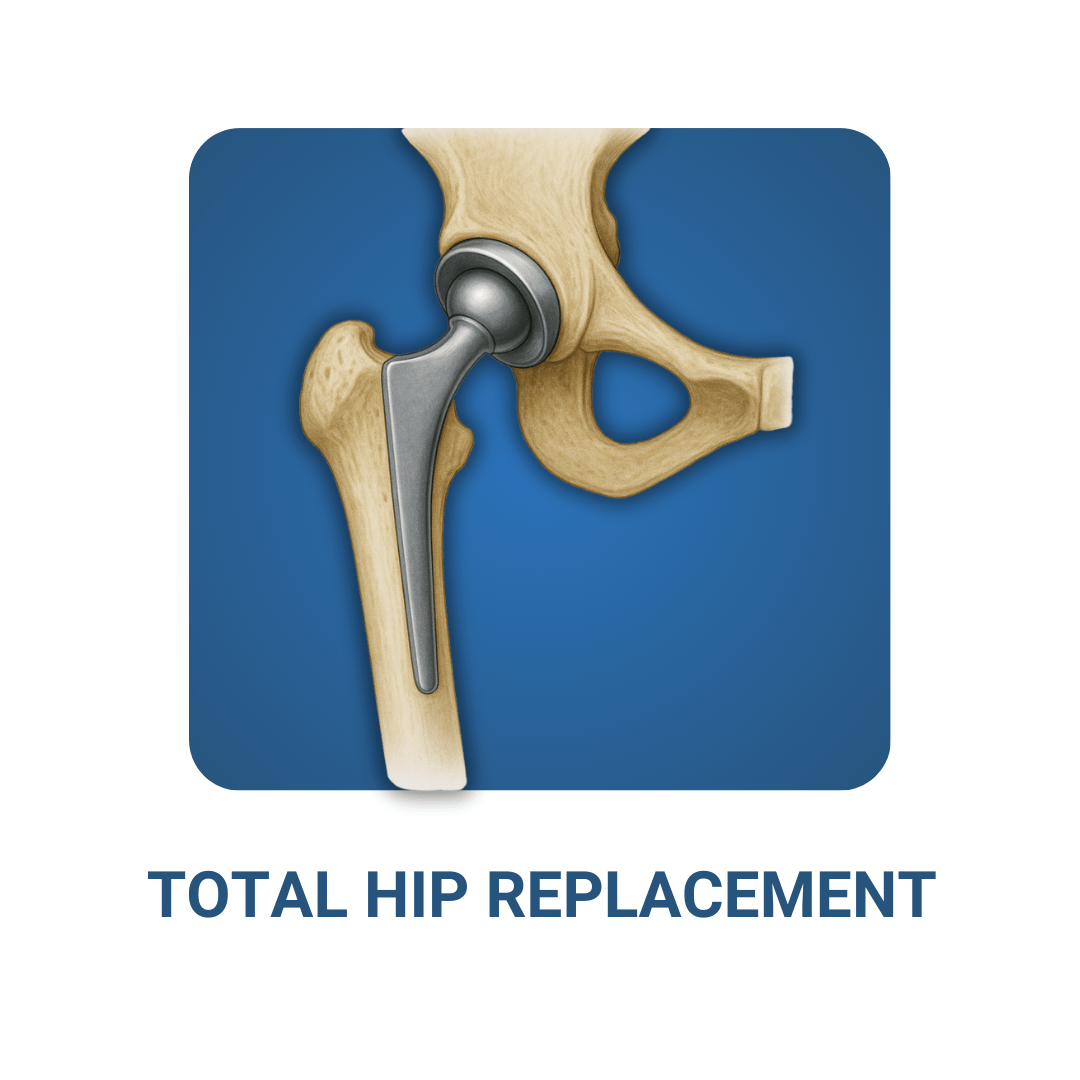 Say Goodbye to Knee Pain. Choose Robotic Joint Replacement